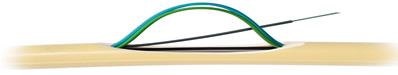 Cable distri a micro modules ftth 48 fo - modulo 4